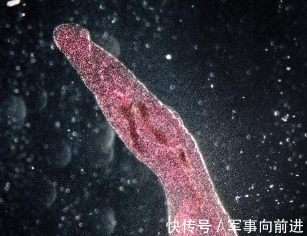 阿姨|45岁阿姨便秘半年,一查是肠癌晚期,身体出现3个症状,要小心