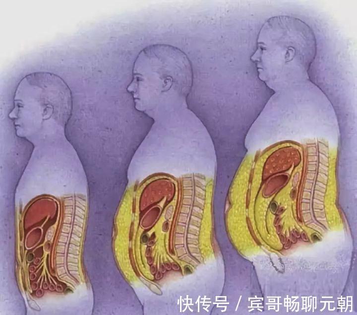 脂肪肝|为什么中年人腹部脂肪会越来越多3条建议助你恢复良好体态