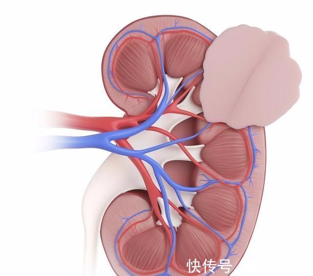 降糖|二甲双胍单用效果不理想?给你3种联用方案,降糖效果加倍