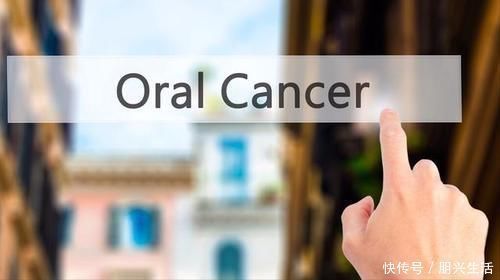 手术切除|口腔癌手术成功率如何?中晚期口腔癌能活多久?答案或会让你安心