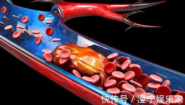 患者|血压控制到多少血管才不会爆裂警惕血压失控,随时可能脑出血