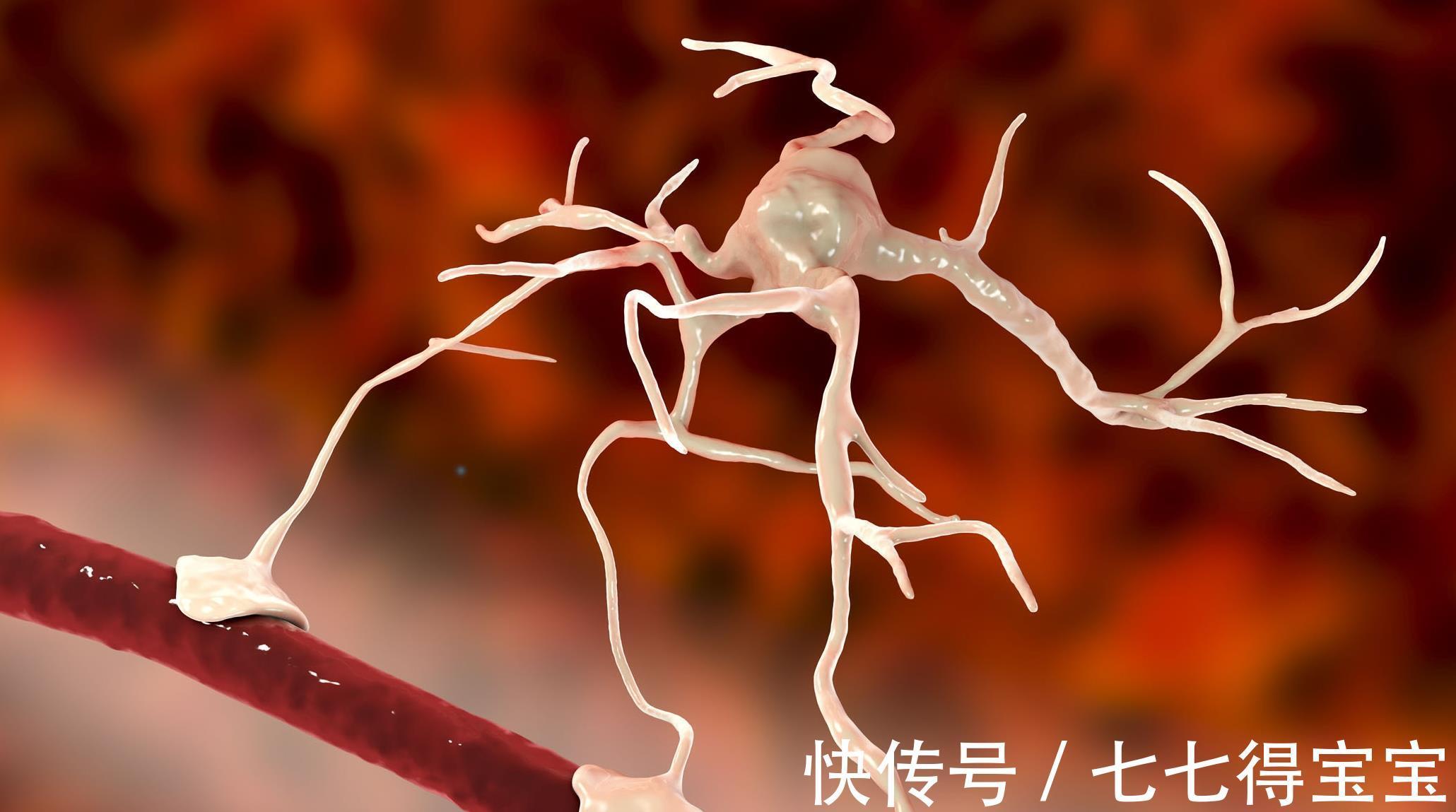 血管堵塞|“溶栓高手”已揭晓，并非海带和木耳，常吃点，给血管来个大扫除