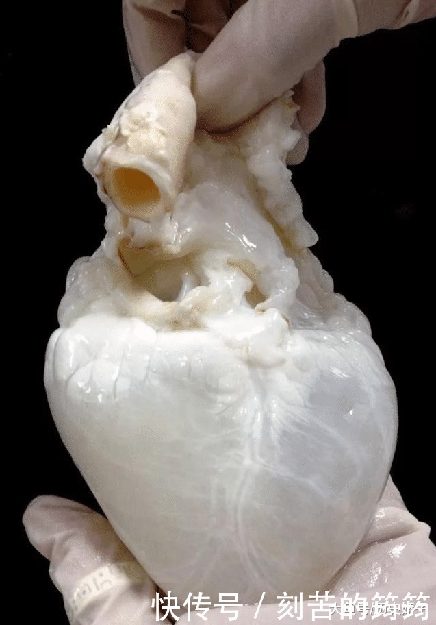 电子显微镜 22张“活久见”的照片,令人大开眼界!