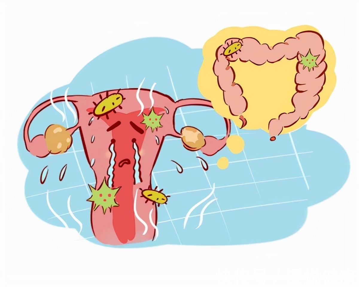 检查|宫颈有癌,内裤先知?内裤若有4种迹象,女性越早检查越好!