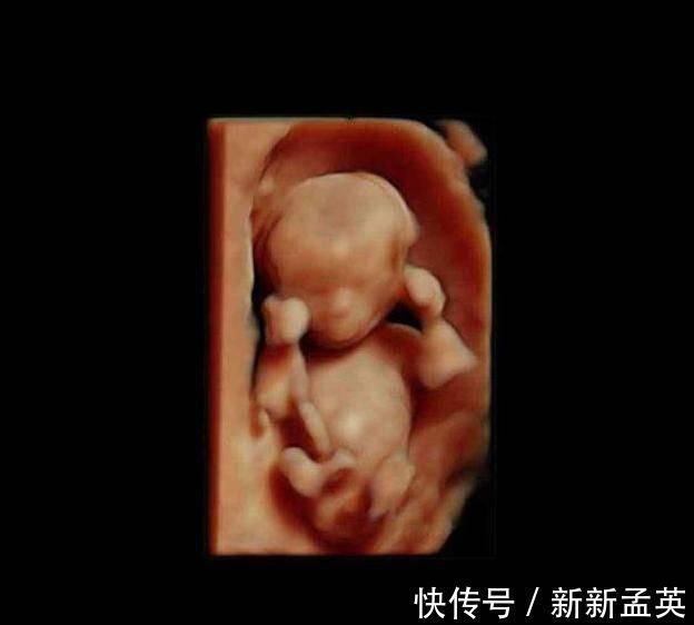 胚胎|胎儿从卵泡到性别形成,17张图片清晰诠释,男宝女宝看得很清楚