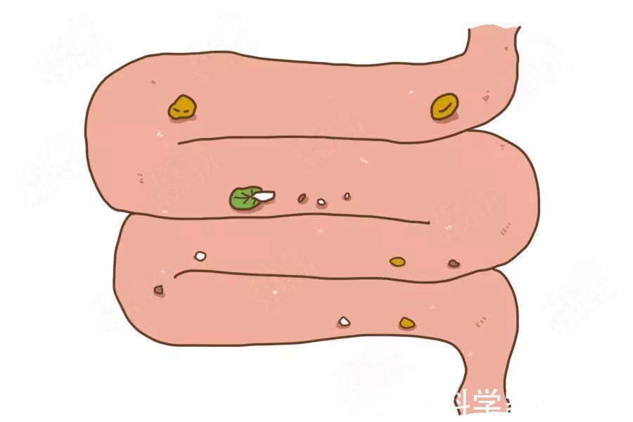 克星|吃香蕉不通便,越吃越堵!这些水果才是“便秘克星”