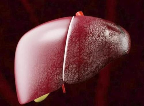 肝脏|南瓜是肝病“发物”?医生提醒:爱吃这3种蔬菜,肝功能容易受损