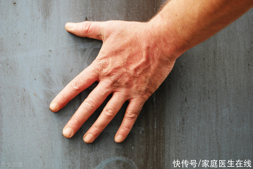 肝功能|肝脏好不好，“手脚”先知道，这3种表现要留意了，这些检查项目可以帮到你