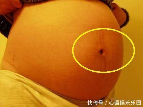 眼儿|女性怀孕后,肚脐眼是凸起是凹进,受3个因素影响,别轻易忽视