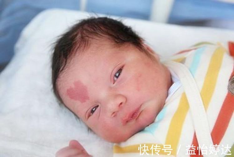 死法|胎记暗示“前世死法”?网友讨论引争议,这些揣测都是谣言