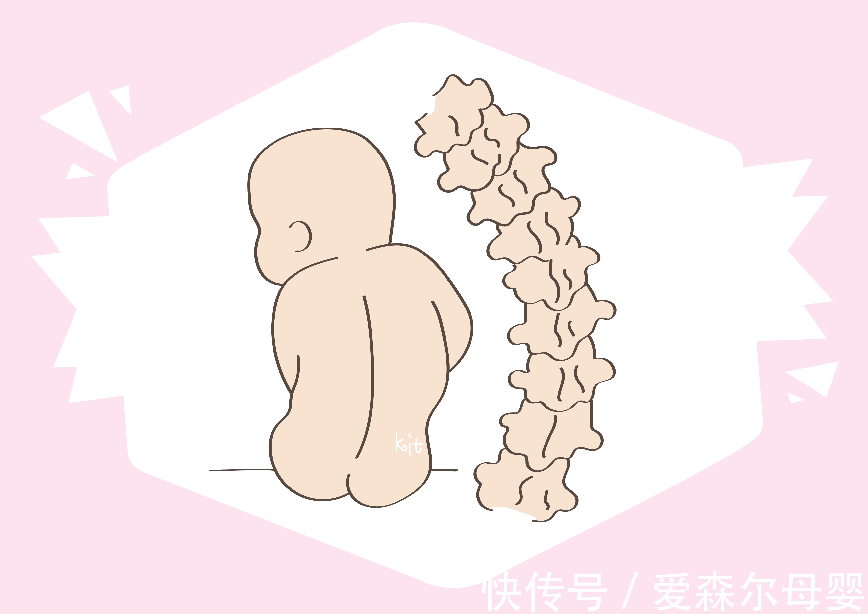 鹏鹏|才六个月大的宝宝,脊柱已经出现变形,这些错误行为要注意