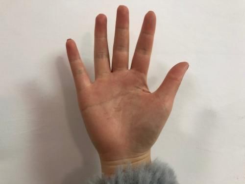 试一试握紧拳头30秒，如果你的血太浓了，就可能有这1个表现