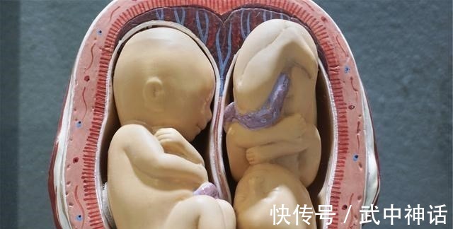 畸形|为什么现在胎停发生率这么高拒绝胎死腹中，孕早期孕妈做好3点