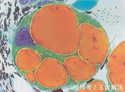 体脂率|减肥并不等于减重，身体出现这4个“信号”，或许才是变瘦的标志