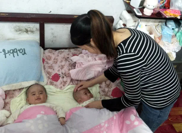 姚甜甜|早产双胞胎姐妹遭遇罕见病,出生时不足两斤,腿还没爸爸手指粗