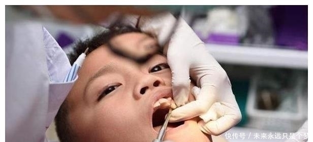 医生|6岁女儿长出双排牙能拔吗?医生说出原因后,妈妈:不该这样喂你