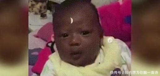 夫妻都是黄种人,却生出“黑人宝宝”,新生儿皮肤为何如此奇怪