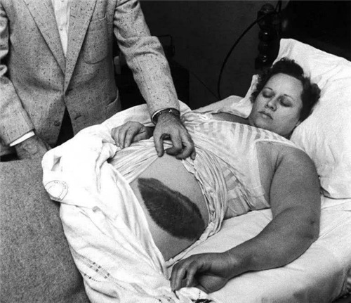 美国唯一被陨石砸中的人,虽只受了轻伤,但后续麻烦却改变她一生