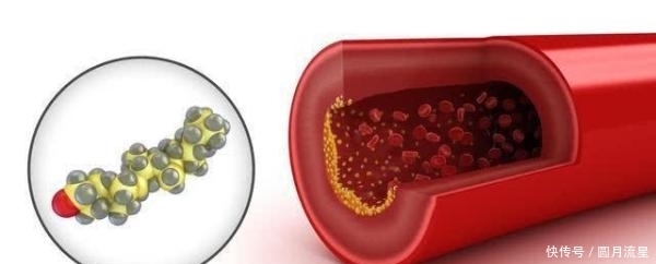 这些食物是降血脂的“高手”经常吃一吃 血脂不会高