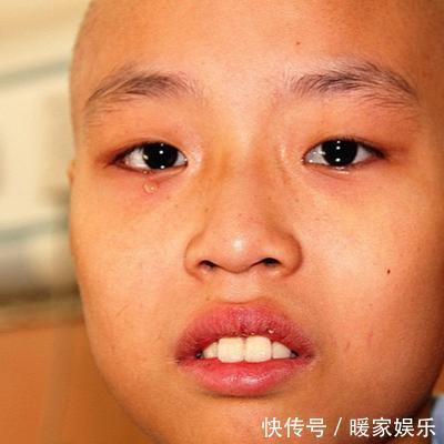 去世|爸爸奶奶等4名至亲相继患癌去世，10岁女孩也患癌现在轮到我了