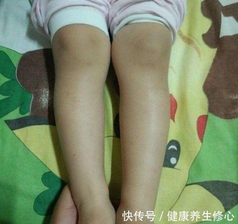 部位|孩子身体的3个部位有这些特征,将来多半是大高个,中了就偷乐吧!