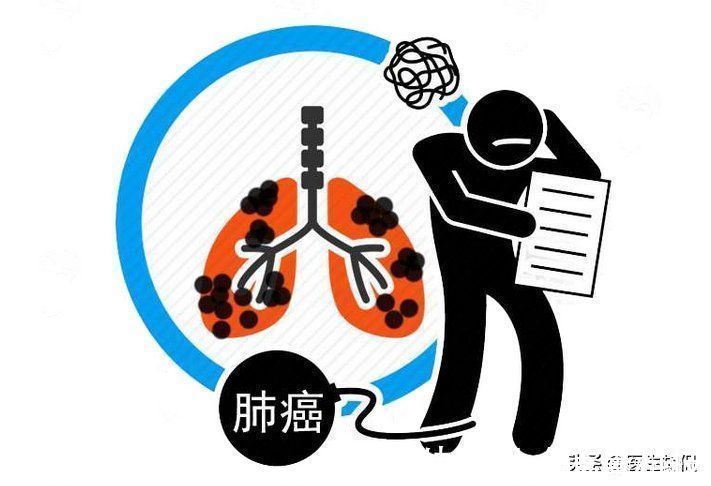 肺部|肺癌是拖出来的!医生忠告,每天早晚做好4件事,肺会更好