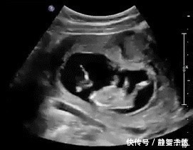 胎宝|胎宝也会肚子饿，孕妈收到这三种“信号”，说明需要补充能量了