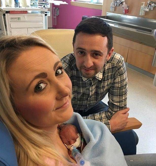 阿乐|英国妇女在怀孕21周时生下一个孩子宝宝是透明的,可以看到体内的血液流动