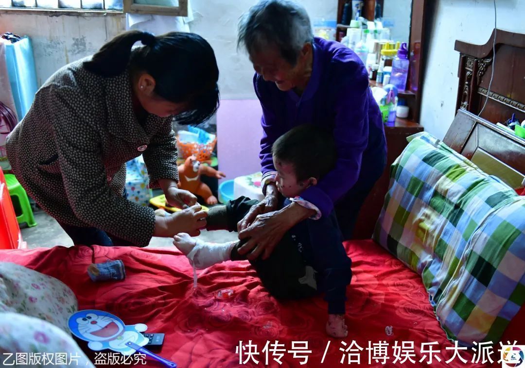 纱布|男童出生患罕见病,三年用掉纱布5000多圈,每天只能坐在床上
