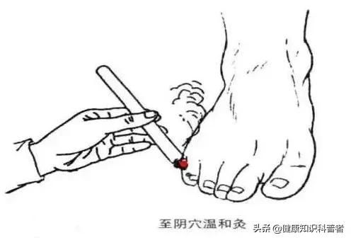 五输穴|六腑分布在指趾末端的六个井穴