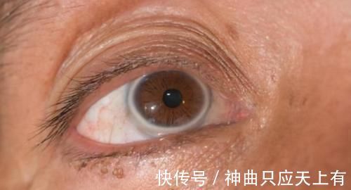 溶栓|“溶栓高手”公布,并非苦瓜,平时敞开吃,血管干净,远离头晕手麻