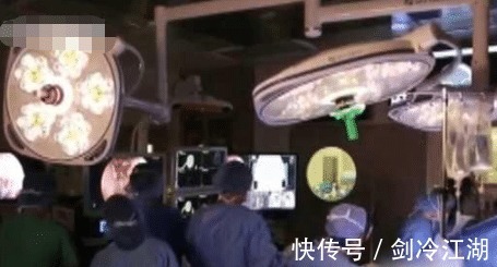 脑部|男子流“鼻涕”五年以为是过敏, 滴到碗里后才“发现”是脑脊液