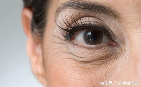 肌肤|女性衰老时，往往会有“1多1深1宽”若没中，恭喜，还很年轻