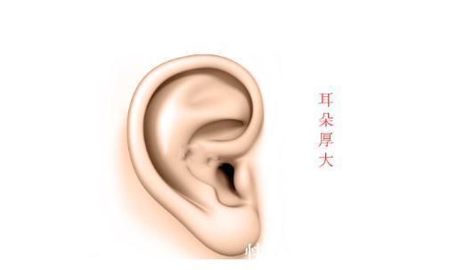 耳相|五种发财金耳，有头脑，富甲一方，健康又高寿