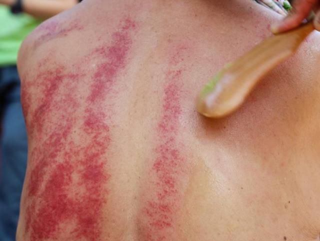 宝宝|都2020年了，你还在用这些方法退烧？宝宝真的被“坑”惨了！