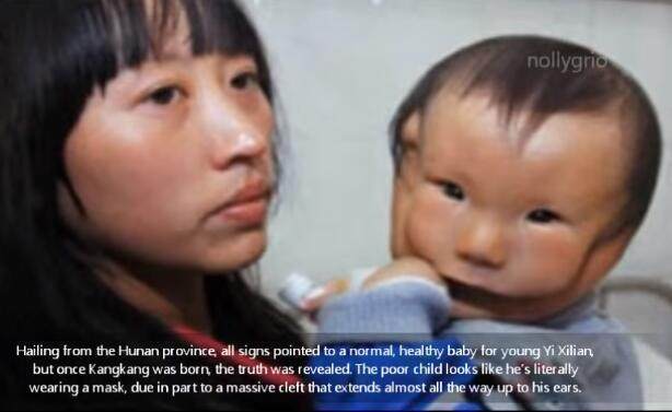 康康|宝宝安全出生,可妈妈看到宝宝的样子失声痛哭!