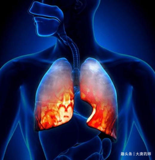 冰糖银耳羹|肺不好不能吃茄子5种食物不妨多吃,养肺护肺,肺好百病消!