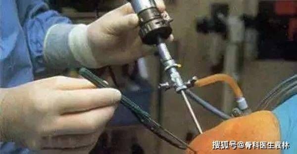 关节炎|老年人关节炎该怎么治疗?老年性关节炎怎么治疗?