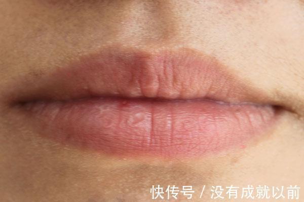 气血不足|气血不足的女性,身体会有两处发白,饮食做到三多,帮你补充气血