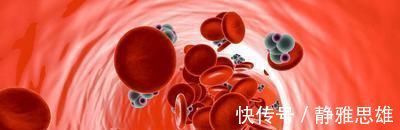 戒烟|高血脂的原因找到了,做好4个方面,血脂降下,三高悄悄溜走