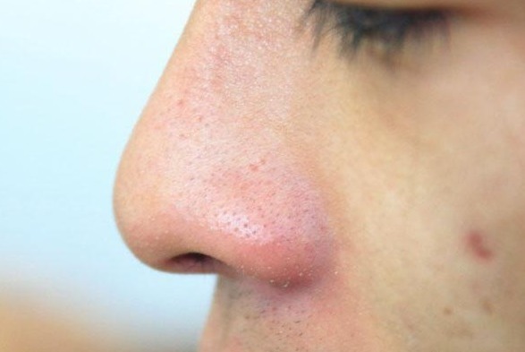 衰老|女人走向衰老，身上会有六种表现，你若没有，说明很年轻