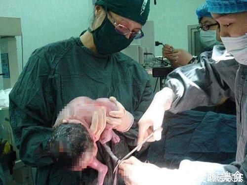 宝宝|新生儿出生后的10多分钟,到底在“折腾”些啥其实他比妈妈忙