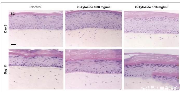 抗老黑科技【玻色因+烟酰胺+角鲨烷】强效抗皱配方,是骗局吗?