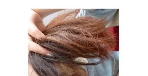 日常生活中|女人衰老以后,身体这6个部位会出现异常,若你没有,说明你还年轻!