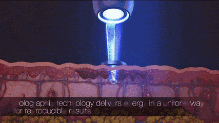 激光治疗|激光治疗术后需要注意哪些?丨科普篇