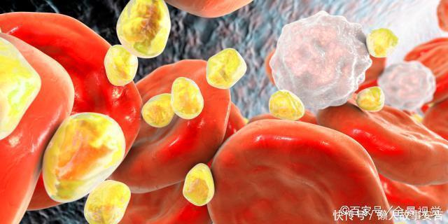 高血脂|甘油三酯“清洁工”找到了,不是苦瓜,1物若爱吃,血脂无影踪