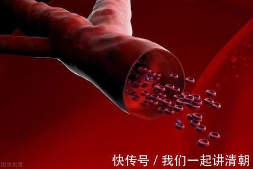 冬天|入冬后，为了血管健康，这些动作尽量少做，中老年群体需要注意