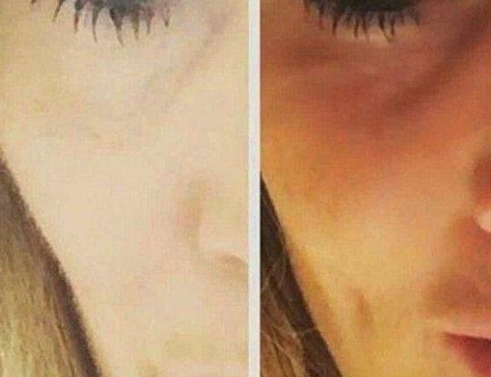 英国女子去美容院做了个酒窝,从那以后却不敢轻易笑