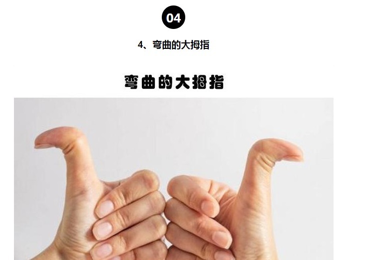 等位基因|罕见的身体特征只有少数人身上才拥有的10个罕见的特征