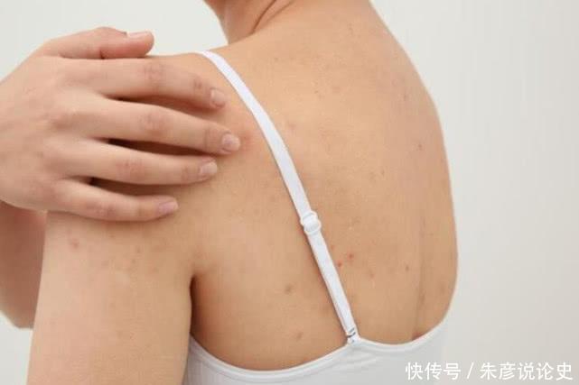 床垫用久了成螨虫窝,用这个土方法立马把螨虫清干净,太聪明了